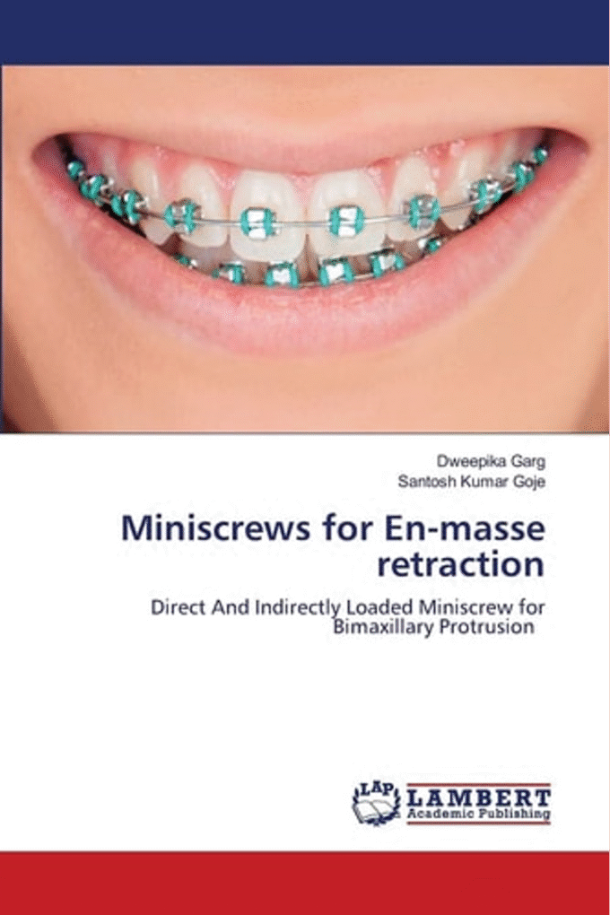 Miniscrews for En-masse retraction: Direct And Indirectly Loaded Miniscrew for Bimaxillary Protrusion